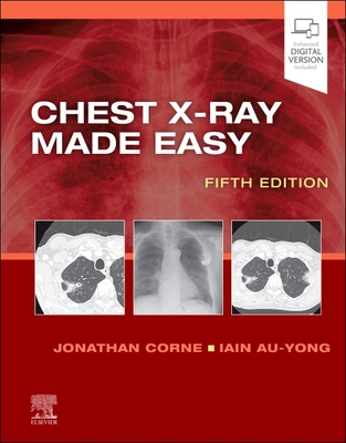 Chest X-Ray Made Easy - Corne, Jonathan, Ma, PhD, MB, Bs, Frcp, and Au-Yong, Iain, Ma