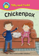 Chickenpox