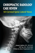 Chiropractic Radiology Case Review: 50 Cervical Spine Lateral Views