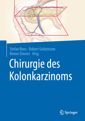 Chirurgie Des Kolonkarzinoms - Benz, Stefan (Editor), and Gr?tzmann, Robert (Editor), and Stinner, Benno (Editor)
