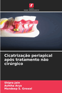 Cicatriza??o periapical ap?s tratamento n?o cirrgico