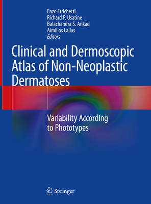 Clinical and Dermoscopic Atlas of Non-Neoplastic Dermatoses: Variability According to Phototypes - Errichetti, Enzo (Editor), and Usatine, Richard P (Editor), and Ankad, Balachandra S (Editor)