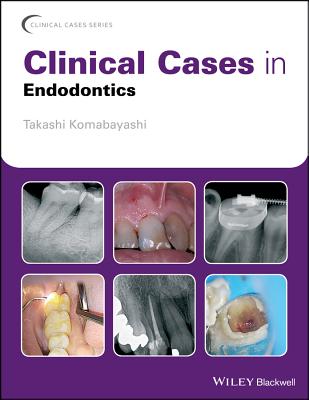 Clinical Cases in Endodontics - Komabayashi, Takashi