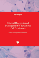 Clinical Diagnosis and Management of Squamous Cell Carcinoma