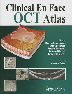 Clinical En Face OCT Atlas - Lumbroso, Bruno, and Huang, David, and Romano, Andre