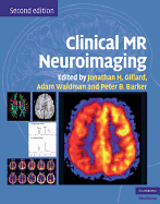 Clinical MR Neuroimaging: Physiological and Functional Techniques