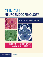Clinical Neuroendocrinology: An Introduction