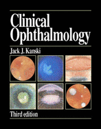 Clinical Ophthalmology: A Systematic Approach