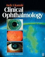 Clinical Ophthalmology: A Systematic Approach