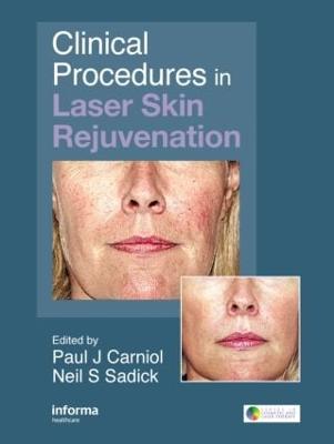 Clinical Procedures in Laser Skin Rejuvenation - Carniol, Paul (Editor), and Sadick, Neil S, MD, Facp (Editor)