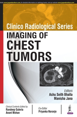 Clinico Radiological Series: Imaging of Chest Tumors - Bhalla, Ashu Seith, and Jana, Manisha