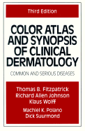 Color Atlas and Synopsis of Clinical Dermatology: Common and Serious Diseases
