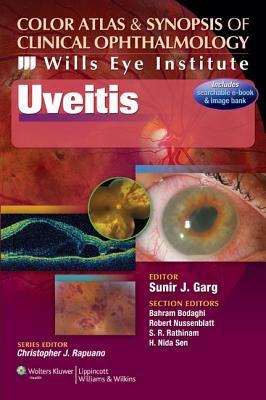 Color Atlas and Synopsis of Clinical Ophthalmology - Wills Eye Institute - Uveitis - Garg, Sunir J