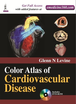 Color Atlas of Cardiovascular Disease - Levine, Glenn N
