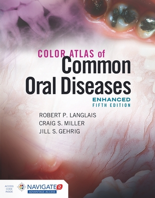 Color Atlas of Common Oral Diseases, Enhanced Edition - Langlais, Robert P, and Miller, Craig S, and Gehrig, Jill S