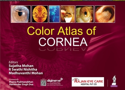 Color Atlas of Cornea - Sujatha, Mohan, and Nishitha, R Swathi, and Mohan, Madhuvanthi