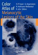 Color Atlas of Melanocytic Lesions of the Skin