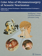 Color Atlas of Microneurosurgery of Acoustic Neurinomas: Endoscope-Assisted Techniques - Neuronavigational Techniques - Radiosurgery