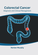 Colorectal Cancer: Diagnosis and Clinical Management