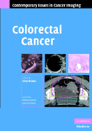 Colorectal Cancer - Brown, Gina (Editor)