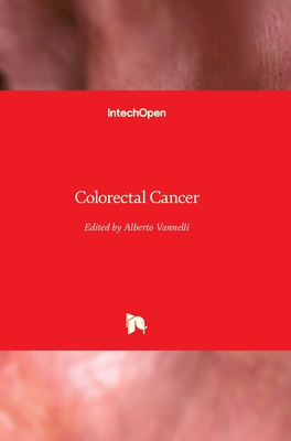 Colorectal Cancer - Vannelli, Alberto (Editor)