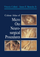 Colour Atlas of Micro-Oto-Neurosurgical Procedures - Colletti, Vittorio, and House, William F. (Introduction by), and Benecke, James E. Jr.