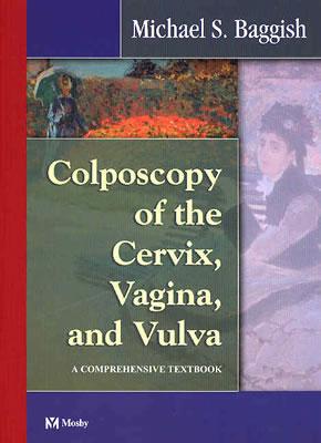 Colposcopy of the Cervix, Vagina, and Vulva: A Comprehensive Textbook - Baggish, Michael S, MD, Facog