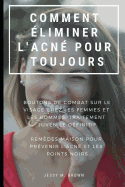 Comment liminer l'Acn Pour Toujours: Boutons de Combat Sur Le Visage Chez Les Femmes Et Les Hommes, Traitement Juvnile Dfinitif Remdes Maison Pour Prvenir l'Acn Et Les Points Noirs