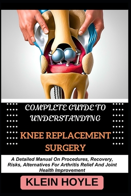 Complete Guide to Understanding Knee Replacement Surgery: A Detailed Manual On Procedures, Recovery, Risks, Alternatives For Arthritis Relief And Joint Health Improvement - Hoyle, Klein