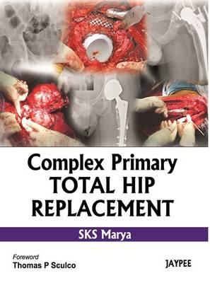 Complex Primary Total Hip Replacement - Marya, SKS