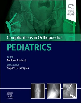 Complications in Orthopaedics: Pediatrics - Schmitz, Matthew (Editor), and Thompson, Stephen, MD, MEd (Editor)