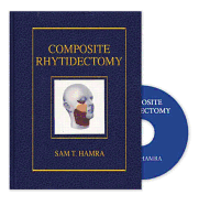 Composite Rhytidectomy