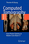 Computed Tomography: From Photon Statistics to Modern Cone-Beam CT