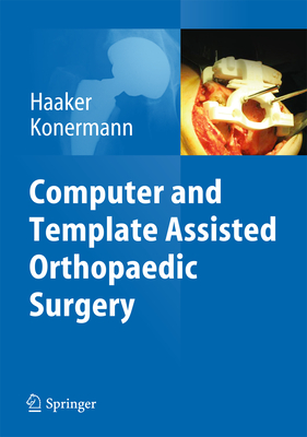 Computer and Template Assisted Orthopedic Surgery - Haaker, Rolf (Editor), and Konermann, Werner (Editor)