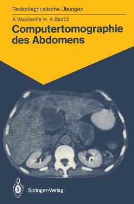 Computertomographie Des Abdomens: 85 Diagnostische bungen Fr Studenten Und Praktische Radiologen - Wackenheim, Auguste, and Hauenstein, Elisabeth (Translated by), and Badoz, Armelle