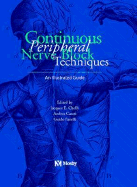 Continuous Peripheral Nerve Blocks: An Illustrated Guide - Chelly, Jacques, and Fanelli, Guido, and Casati, Andrea