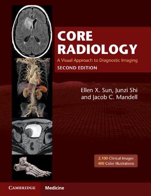Core Radiology: A Visual Approach to Diagnostic Imaging - Sun, Ellen X (Editor), and Shi, Junzi (Editor), and Mandell, Jacob C (Editor)
