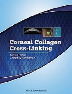 Corneal Collagen Cross Linking - Hafezi, Farhad, MD, and Randleman, J Bradley, MD