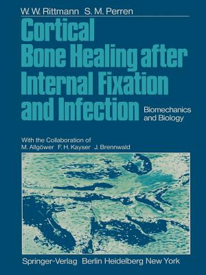 Cortical Bone Healing After Internal Fixation and Infection: Biomechanics and Biology - Allgwer, M, and Rittmann, W W, and Kayser, F H