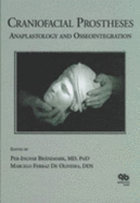 Craniofacial Prostheses: Anaplastology and Osseo Integration - Branemark, Per-Ingva, and Oliveira, Marcelo F
