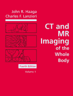 CT and MR Imaging of the Whole Body: 2-Volume Set
