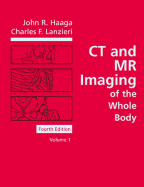 CT and MR Imaging of the Whole Body: 2-Volume Set - Haaga, John R, and Boll, Daniel, MD, and Lanzieri, Charles F, MD