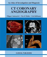 CT Coronary Angiography: Atlas of Investigation and Management - Cademartiri, F., and Mollet, N.R., and Hoffmann, U.