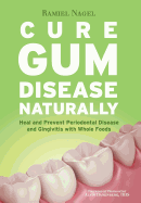 Cure Gum Disease Naturally: Heal Gingivitis and Periodontal Disease with Whole Foods