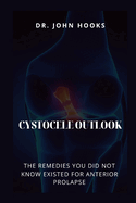 Cystocele Outlook: The Remedies You Did Not Know Existed for Anterior Prolapse