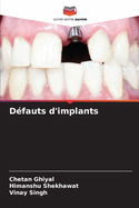 Dfauts d'implants