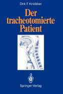 Der Tracheotomierte Patient