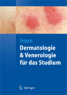 Dermatologie Und Venerologie Fr Das Studium