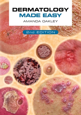 Dermatology Made Easy, second edition - Oakley, Amanda