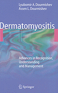 Dermatomyositis: Advances in Recognition, Understanding and Management